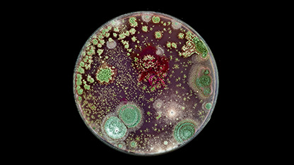  Bacteria and fungi cultured on Petri dish